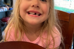 2021-06-11 - Lost Tooth #4