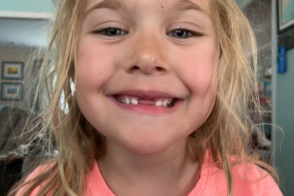 Lost Tooth #5